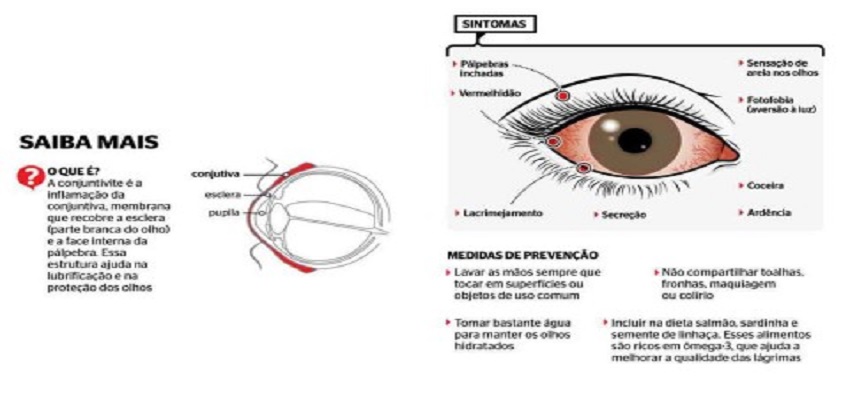 Tipos de conjuntivite 