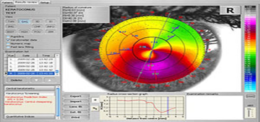 Retinógrafo 3D 