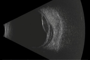  Ultrassonografia (ecografia)