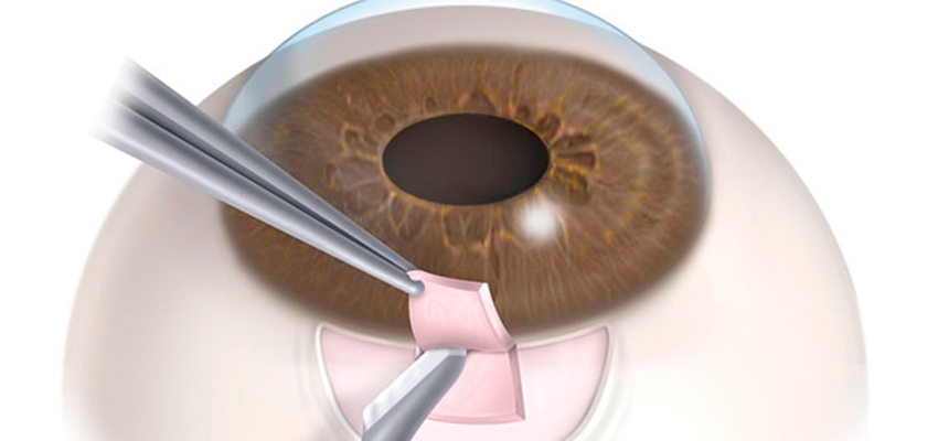 doenças oculares